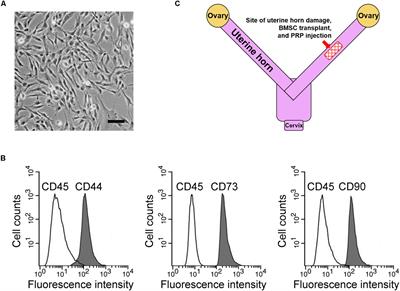 Platelet-Rich Plasma Therapy Enhances the Beneficial Effect of Bone Marrow Stem Cell Transplant on Endometrial Regeneration